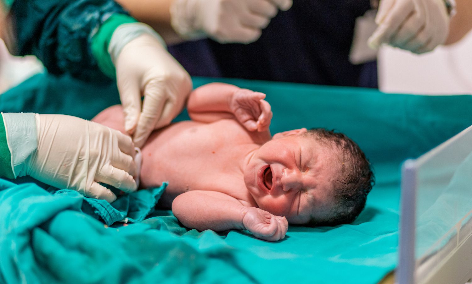Can Caput Succedaneum Be Prevented With A Cesarean Section